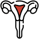 PCOD/PCOS